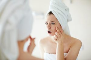 Eliminate Acne Scars From Your Face