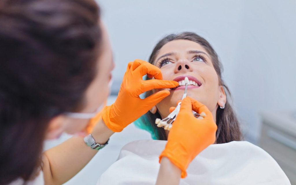 veneers in Toronto